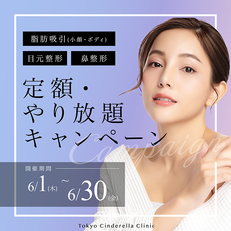 定額・やり放題モニター