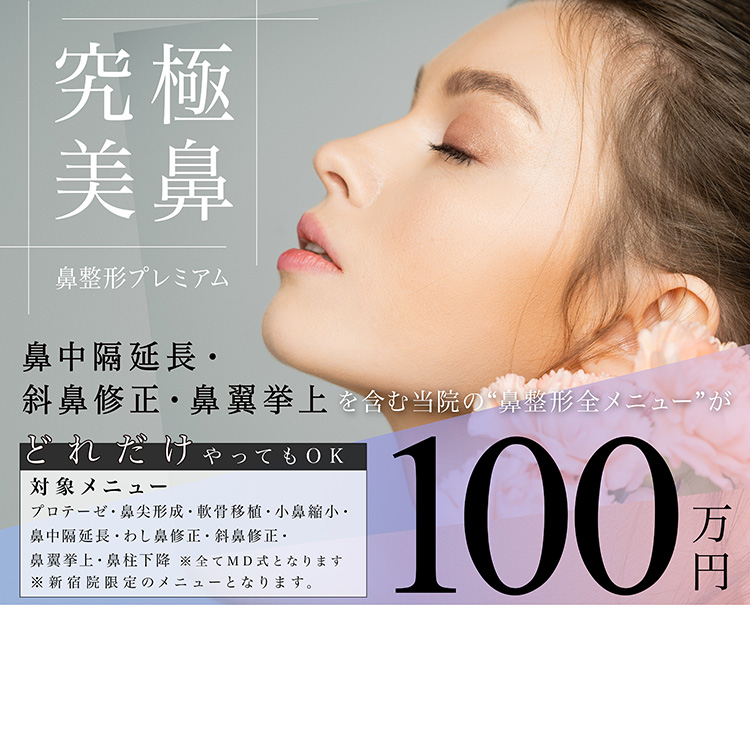 定額・やり放題モニター